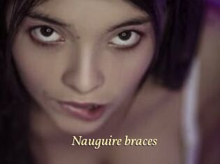 Nauguire_braces